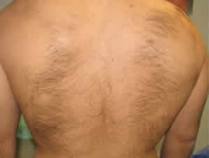 Before