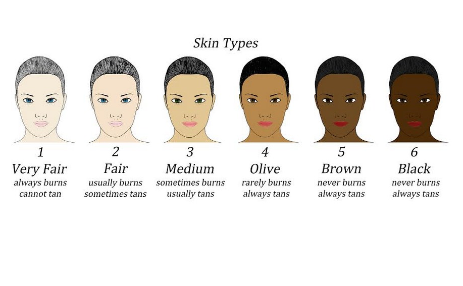 Fitzpatrick Skin Type Chart For Laser