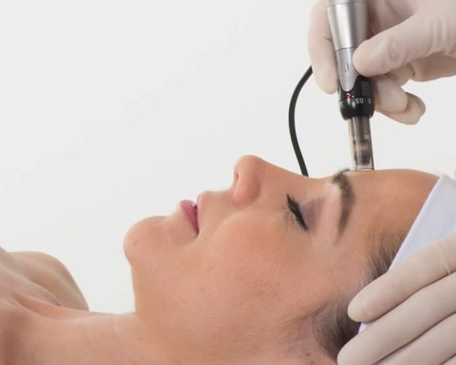 Dermapen Microneedling