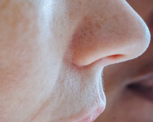 NoseReshaping