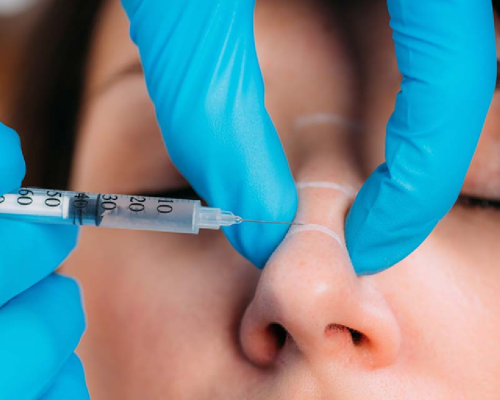 nose fillers